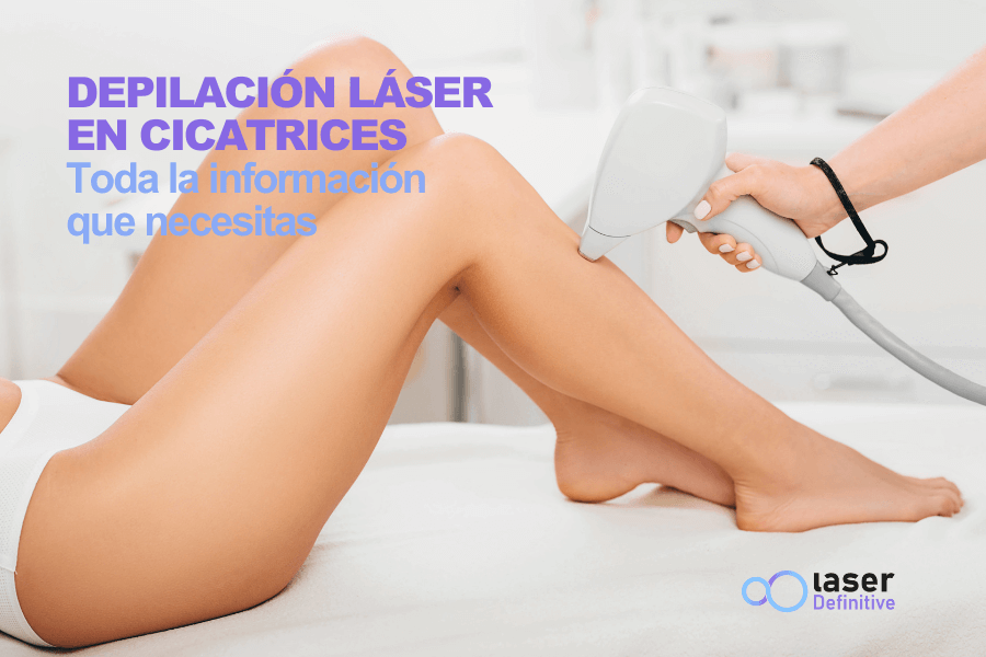 depilacion-laser-cicatrices